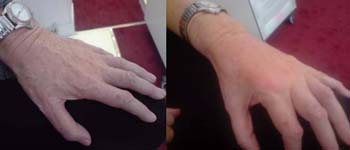 Before - After